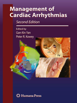 cover image of Management of Cardiac Arrhythmias